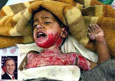 civilian casualties