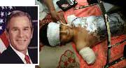 injured boy